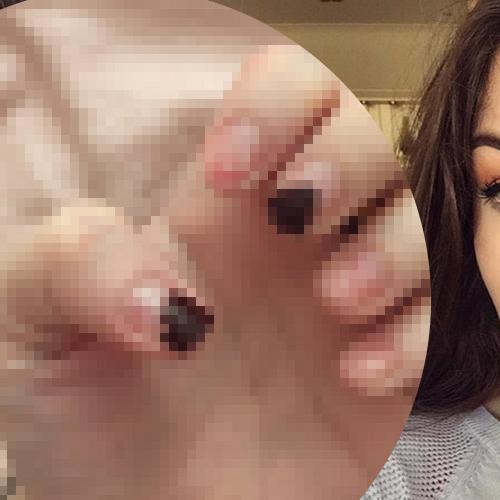 Thought Dr Pimple Popper Was Gross? Wait Till You See This!
