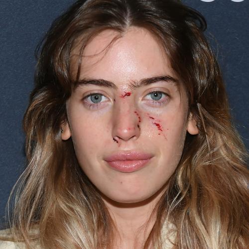 Ewan McGregor’s Daughter Bitten By Dog Just 30 Minutes Before Red Carpet Appearance